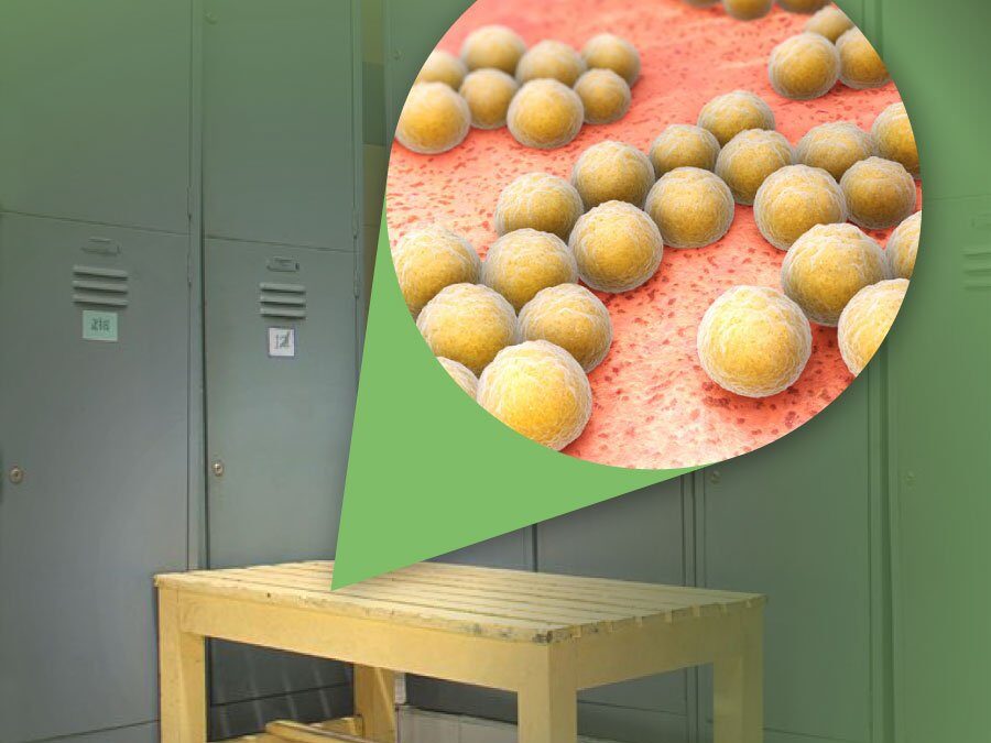 DermUtopia Tip Tuesday: MRSA-Resistant Staph