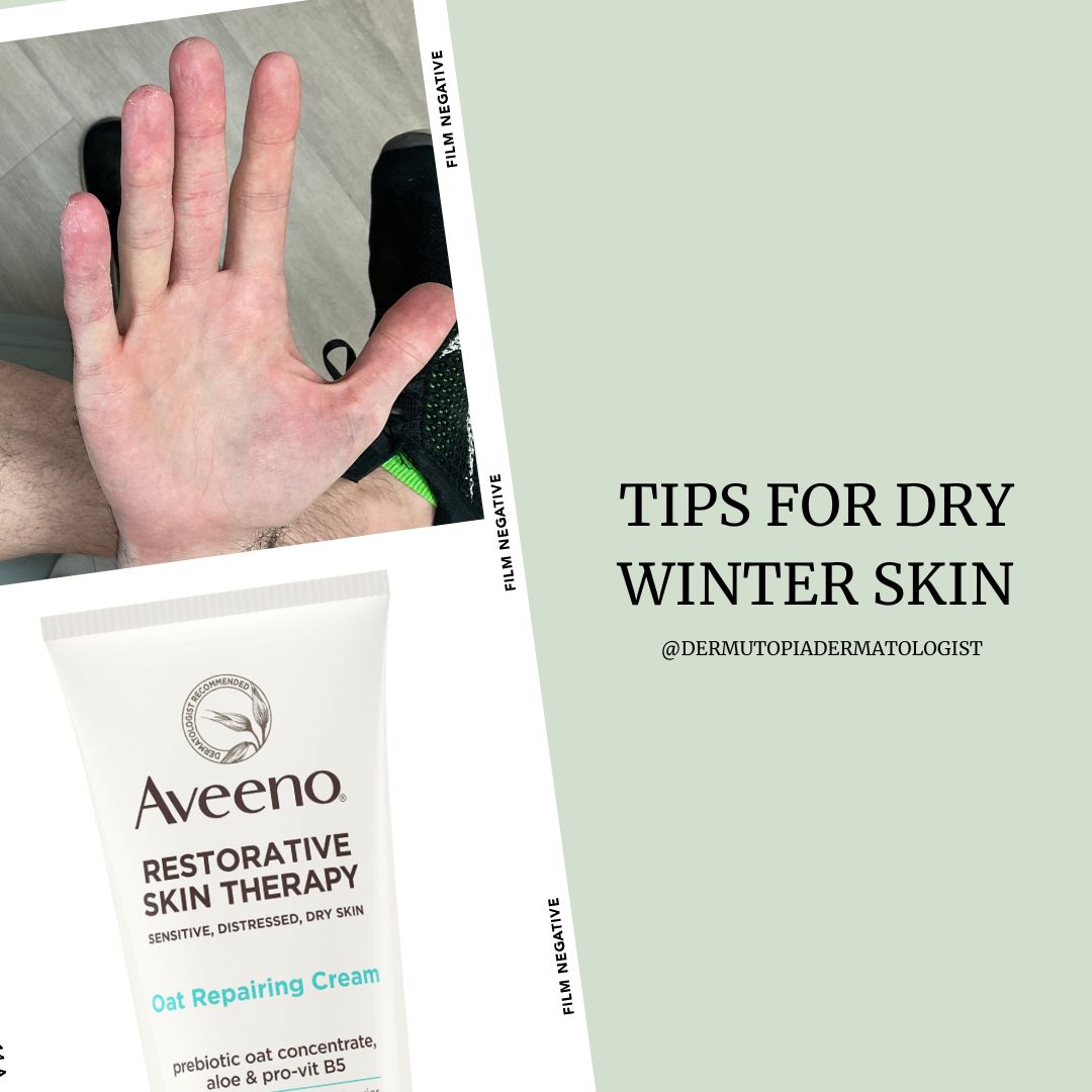 How To Prevent Dry Skin in Winter