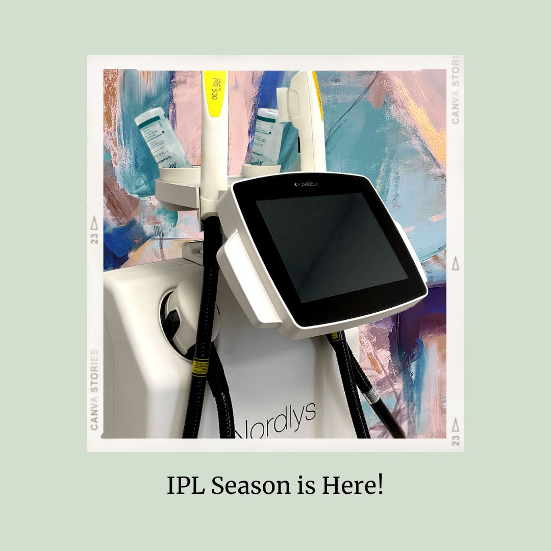 IPL Season is Here!