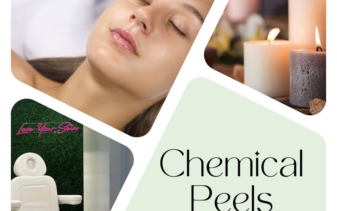 Skincare Hack: Chemical Peels