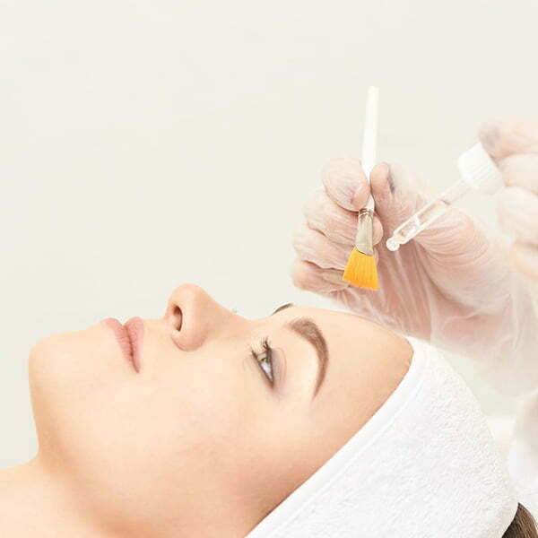 Everything You Need to Know About Chemical Peels