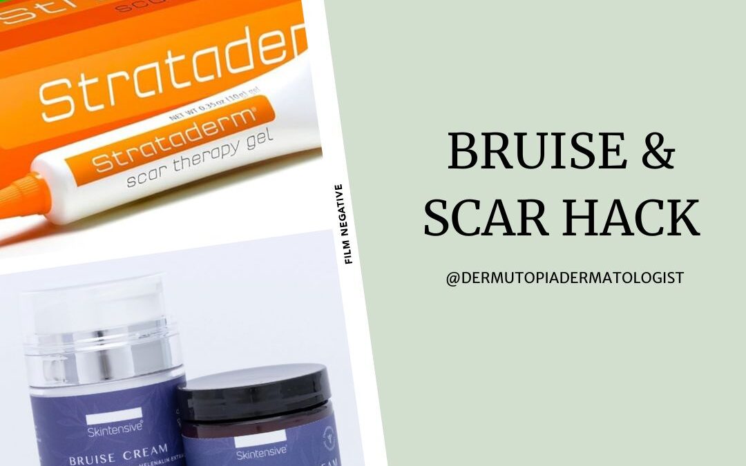 Bruise & Scar Therapy Hacks