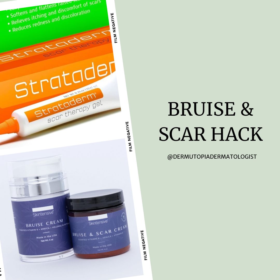 Bruise & Scar Therapy Hacks