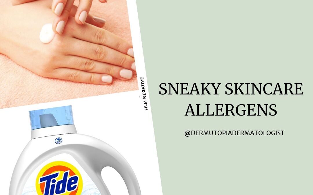 Sneaky Skincare Allergens in Products