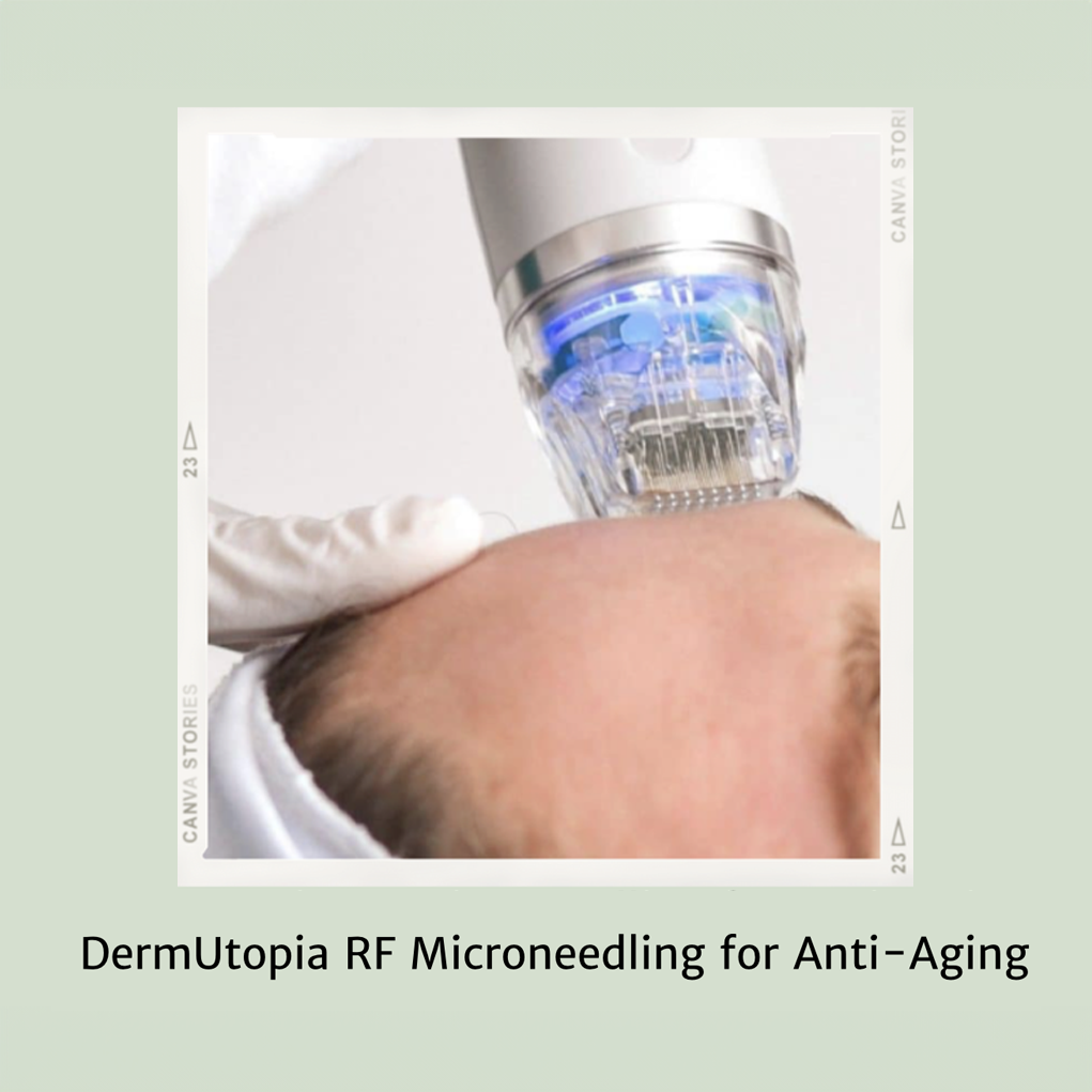 DermUtopia RF Microneedling for Anti-Aging