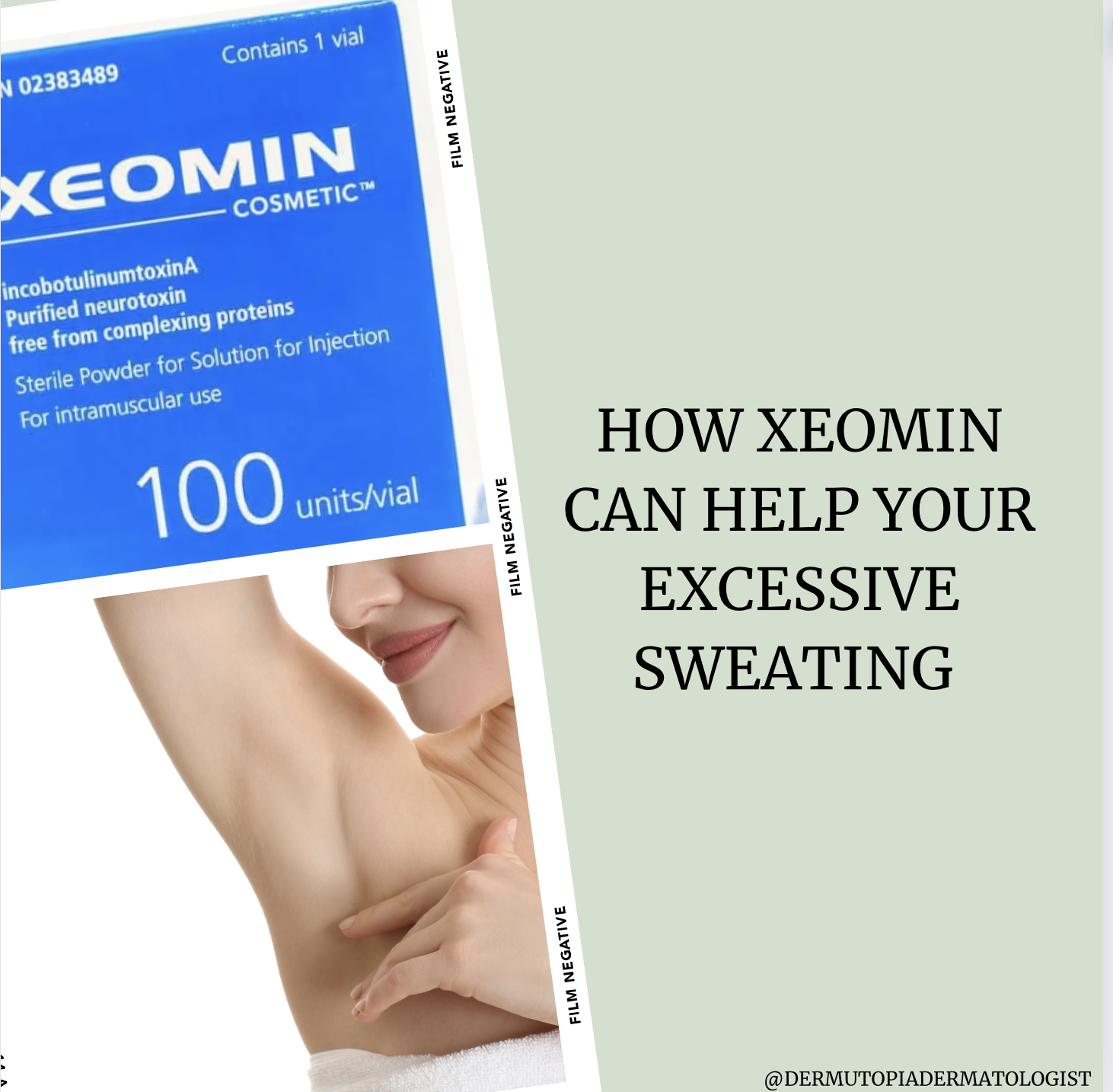 How Xeomin Can Help Your Excessive Sweating