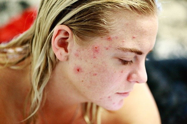 cosmetic dermatologist vienna