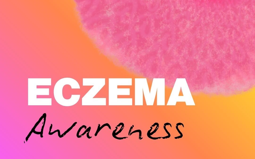 October is Eczema Awareness Month
