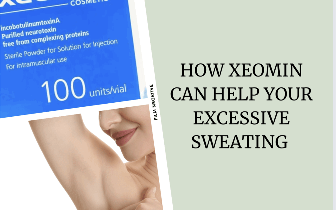 How Xeomin Can Help Your Excessive Sweating